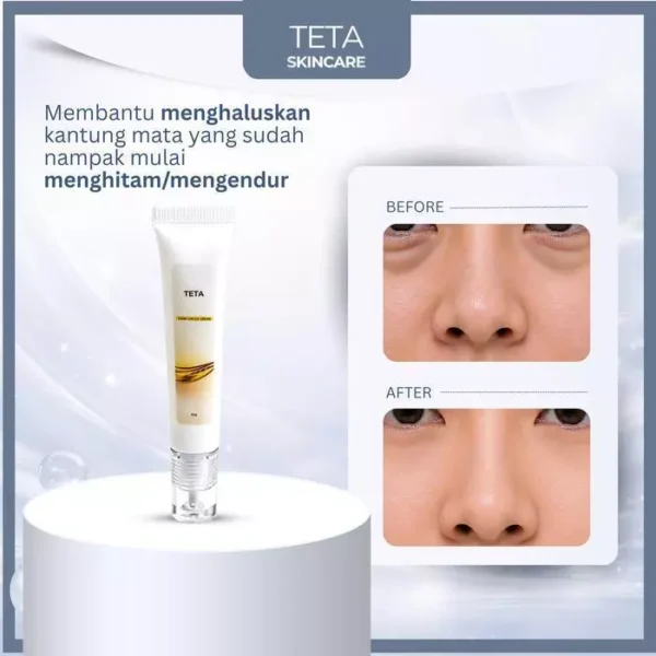 id-11134207-81zto-mt96vwxkbzex5b Cream Mata TETA Skincare Dark Circle Cream Halal BPOM